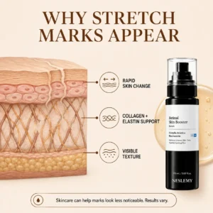 💥100K+ SOLD💕NESLEMY Advanced Retinal Stretch Mark Serum