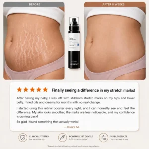 💥100K+ SOLD💕NESLEMY Advanced Retinal Stretch Mark Serum