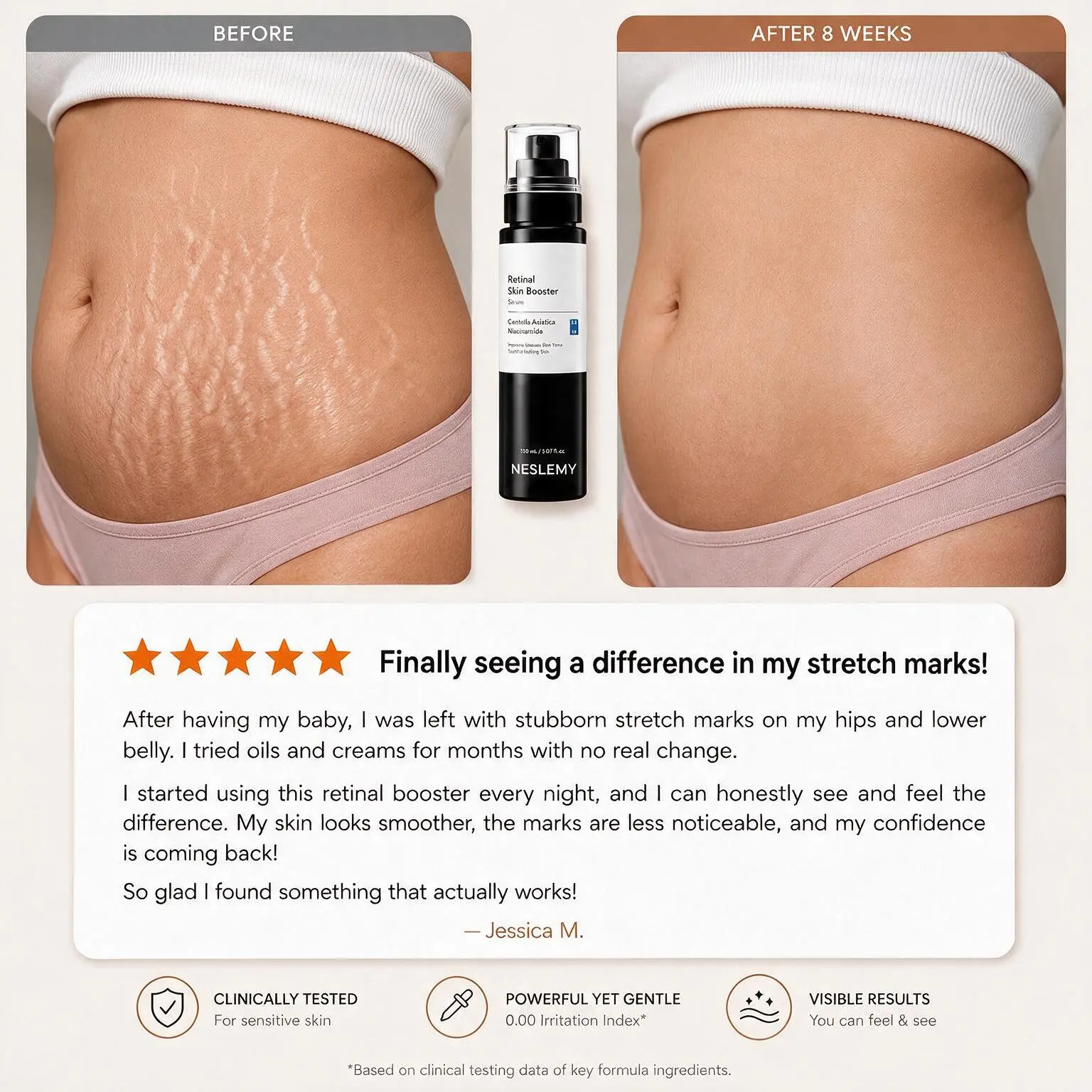 💥100K+ SOLD💕NESLEMY Advanced Retinal Stretch Mark Serum