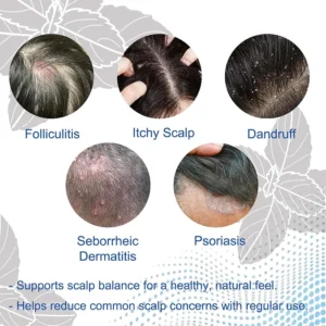 ✨BUY 1 GET 1 FREE✨ NESLEMY  Folliculitis Shampoo for Itchy, Flaky & Oily Scalp!