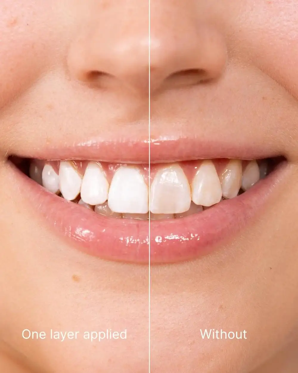 NESLEMY® Tooth Polish - Instant White Smile