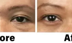 NESLEMY™ Nano Vision Repair Eye Serum ✅FDA Approved(Suitable for presbyopia, dry eye syndrome, glaucoma, and cataracts)