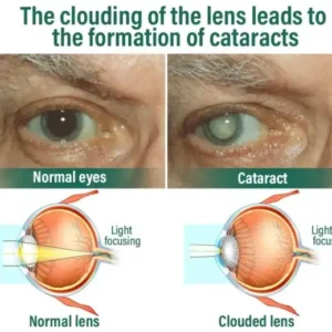 NESLEMY™ Nano Vision Repair Eye Serum ✅FDA Approved(Suitable for presbyopia, dry eye syndrome, glaucoma, and cataracts)