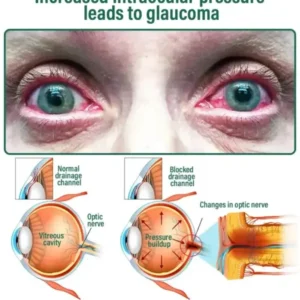 NESLEMY™ Nano Vision Repair Eye Serum ✅FDA Approved(Suitable for presbyopia, dry eye syndrome, glaucoma, and cataracts)
