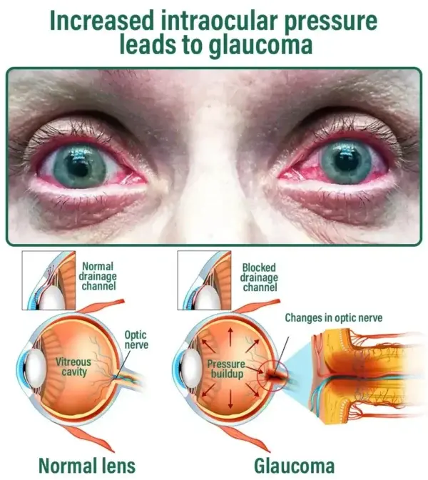 NESLEMY™ Nano Vision Repair Eye Serum ✅FDA Approved(Suitable for presbyopia, dry eye syndrome, glaucoma, and cataracts)