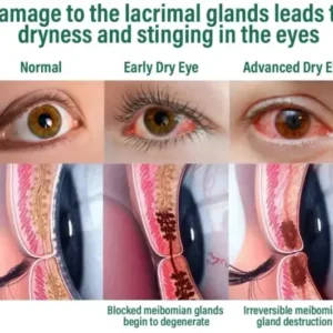 NESLEMY™ Nano Vision Repair Eye Serum ✅FDA Approved(Suitable for presbyopia, dry eye syndrome, glaucoma, and cataracts)